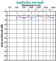 normal hearing audiogram