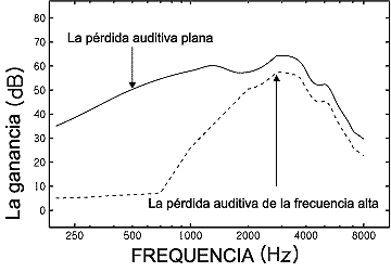 Cómo trabaja un aparato auditivo? - La audición y la amplificación - La  audición de mi bebé